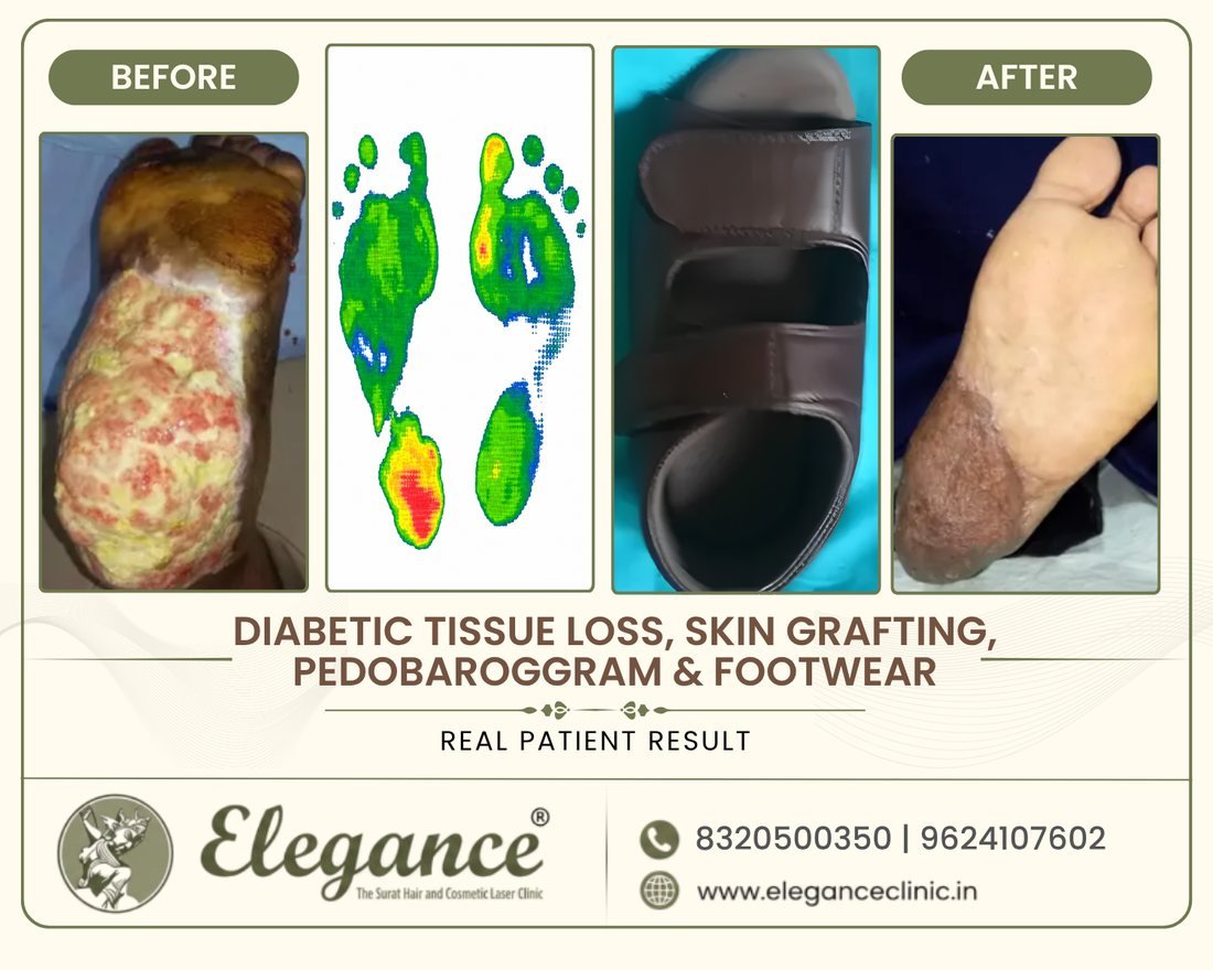 Diabetic Foot Care before and after result