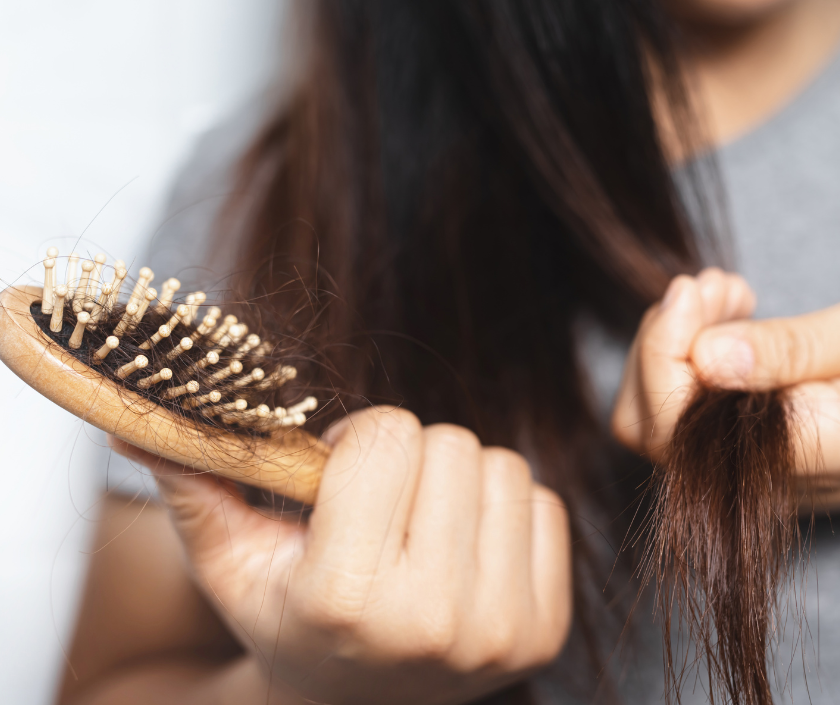 Hair Loss Management in Surat