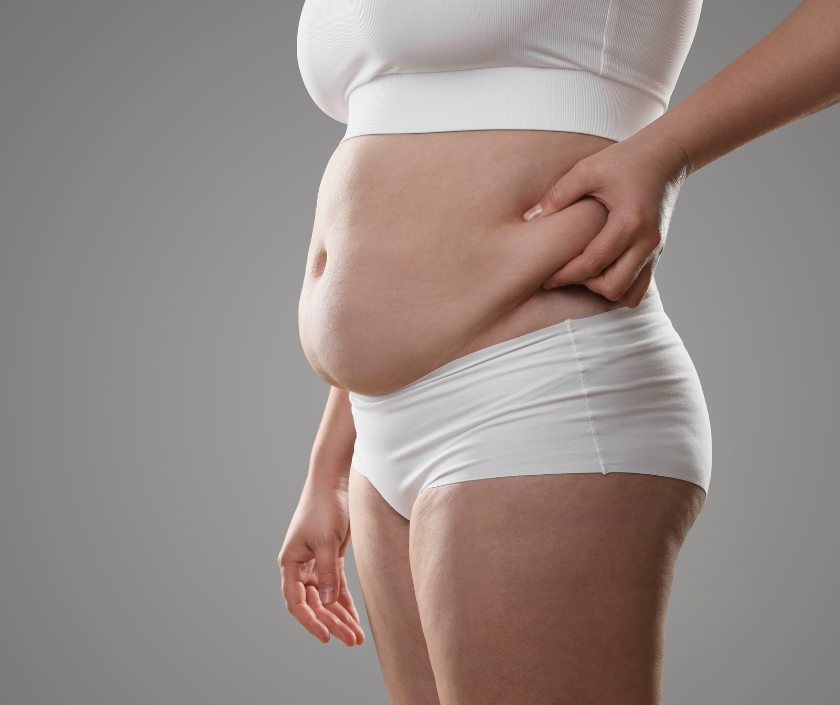 Post Bariatric Surgery in Surat